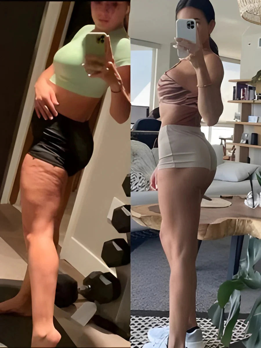 Resultado visual con Bellavora en piernas y caderas