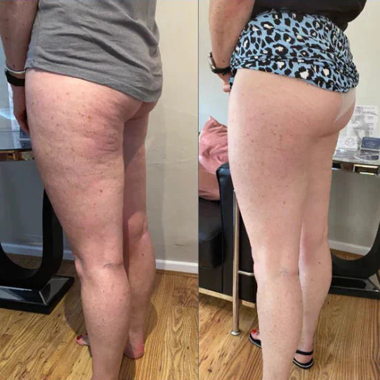 Antes y despues de rutina corporal Bellavora